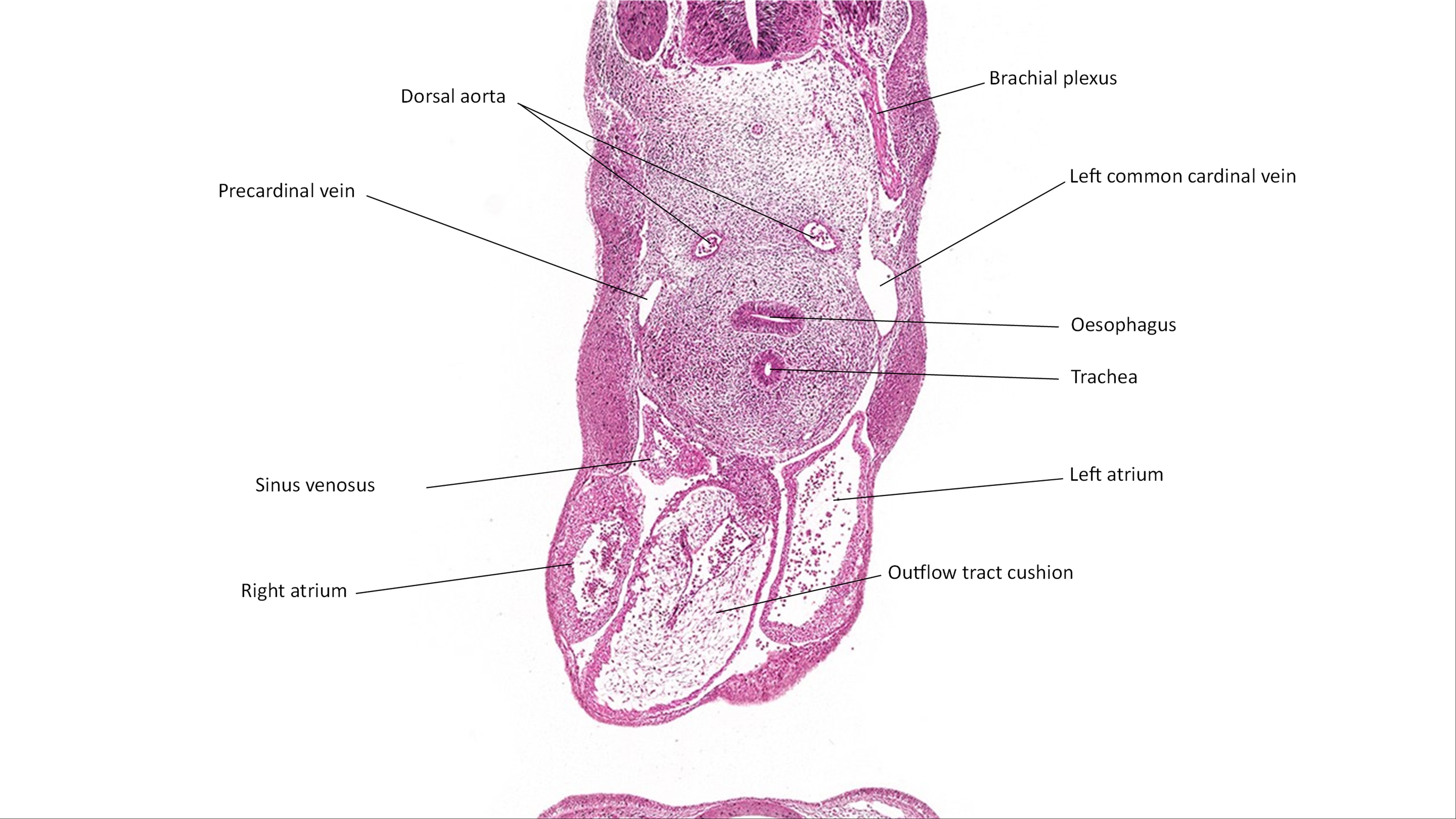 A histology section of a human embryo