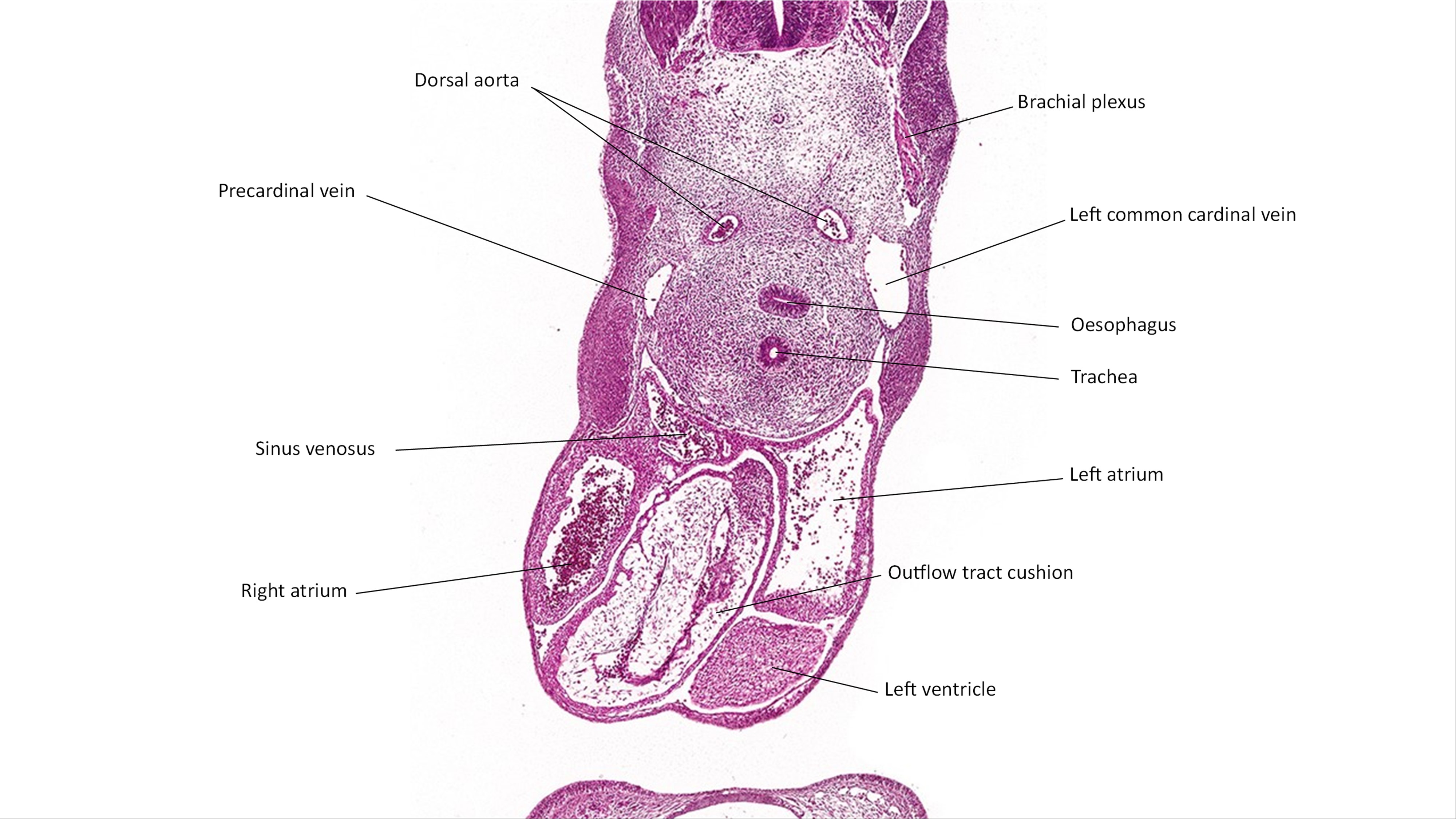 A histology section of a human embryo