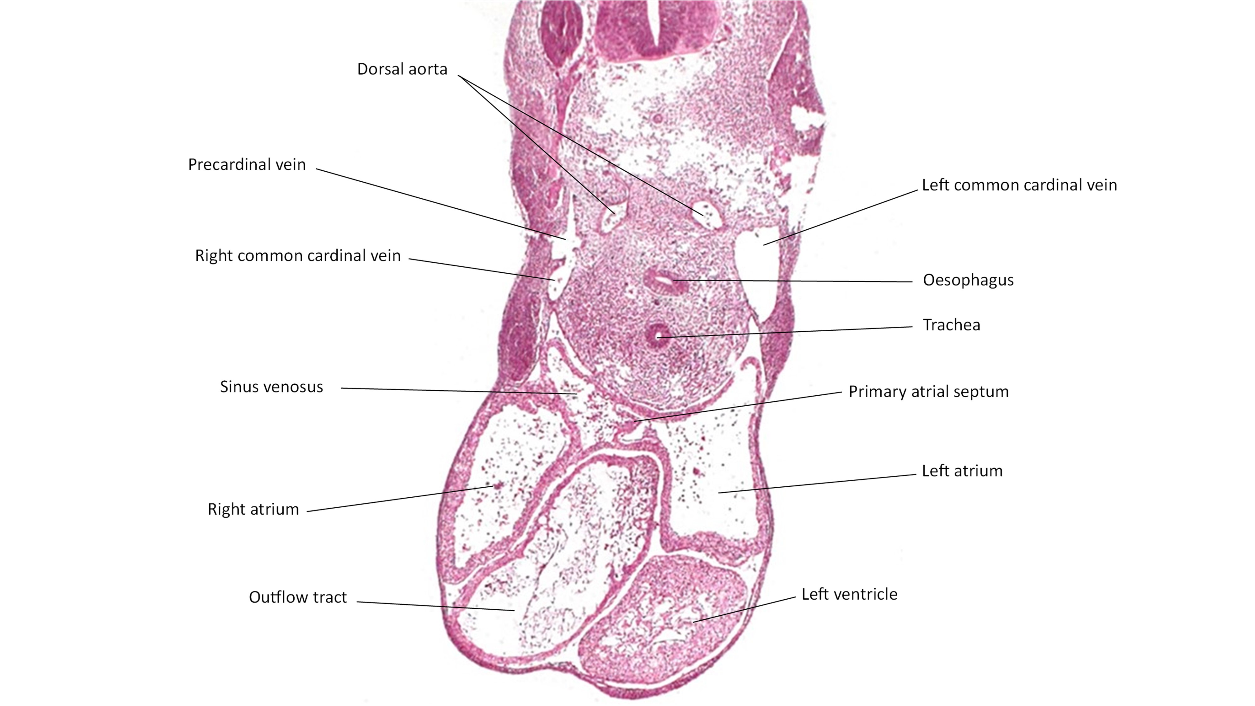 A histology section of a human embryo