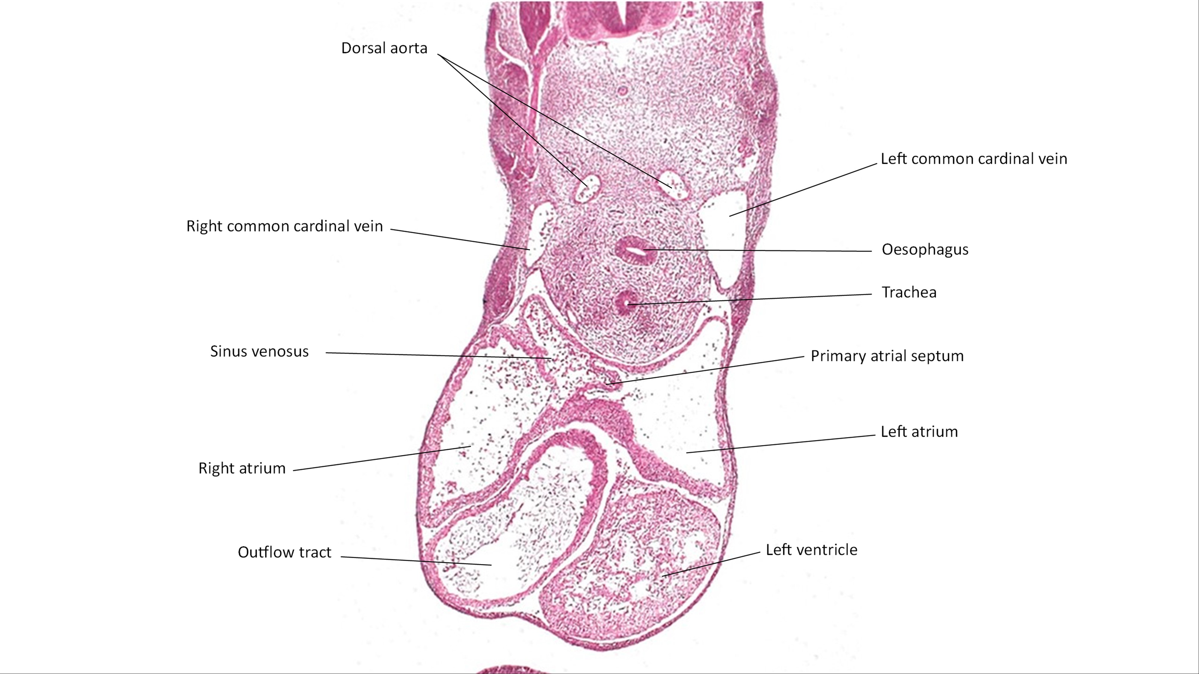 A histology section of a human embryo