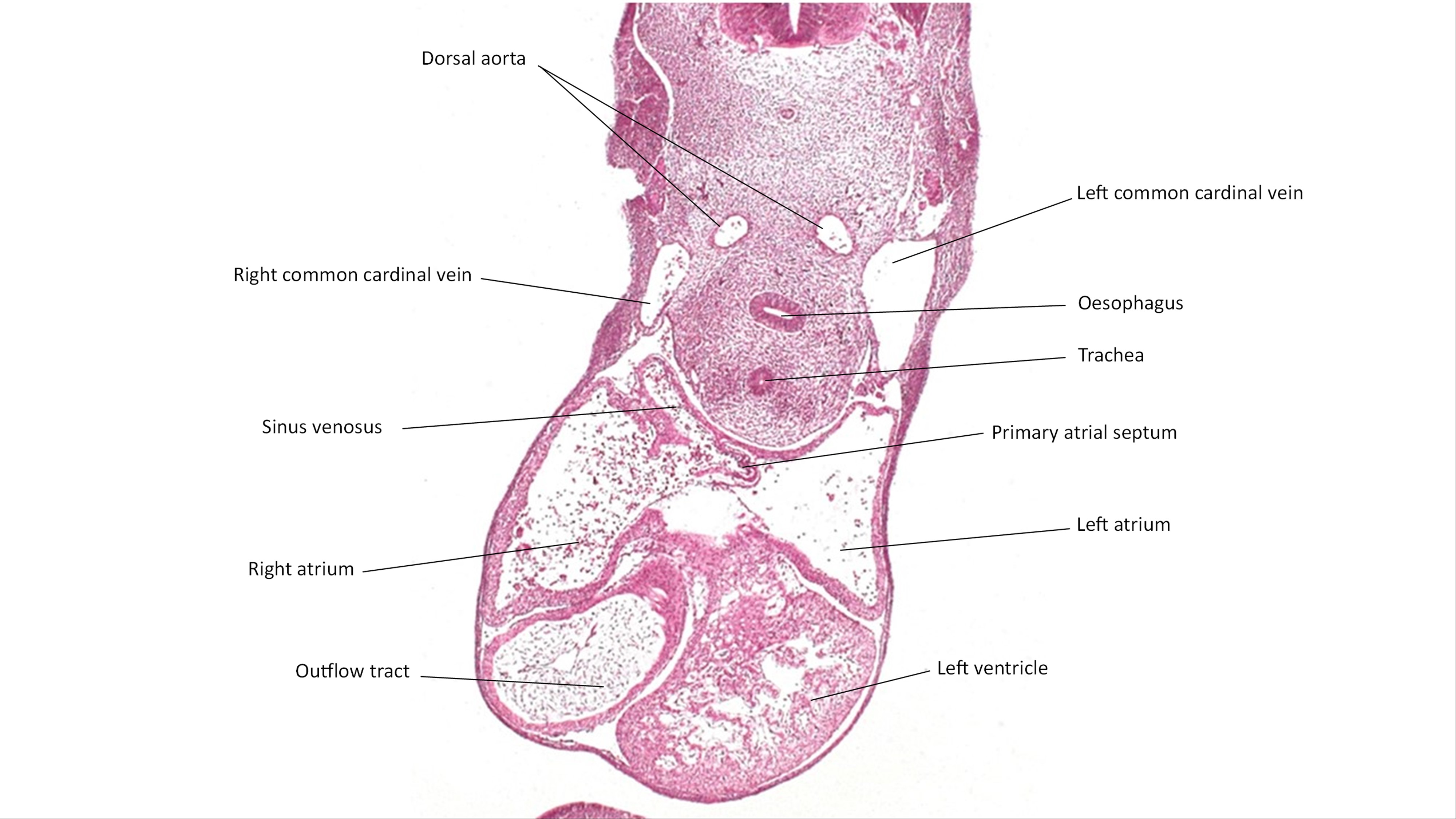 A histology section of a human embryo