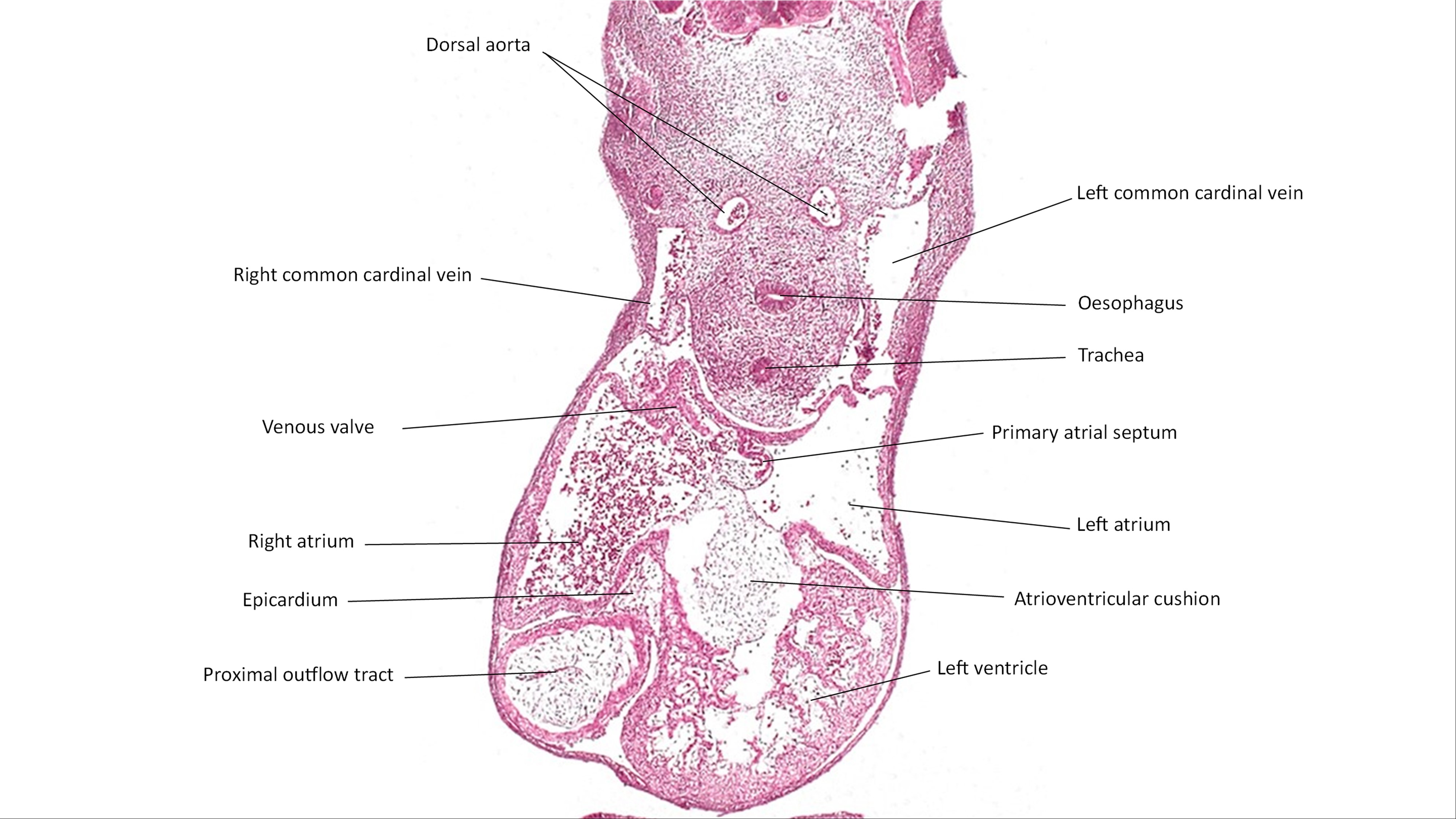 A histology section of a human embryo