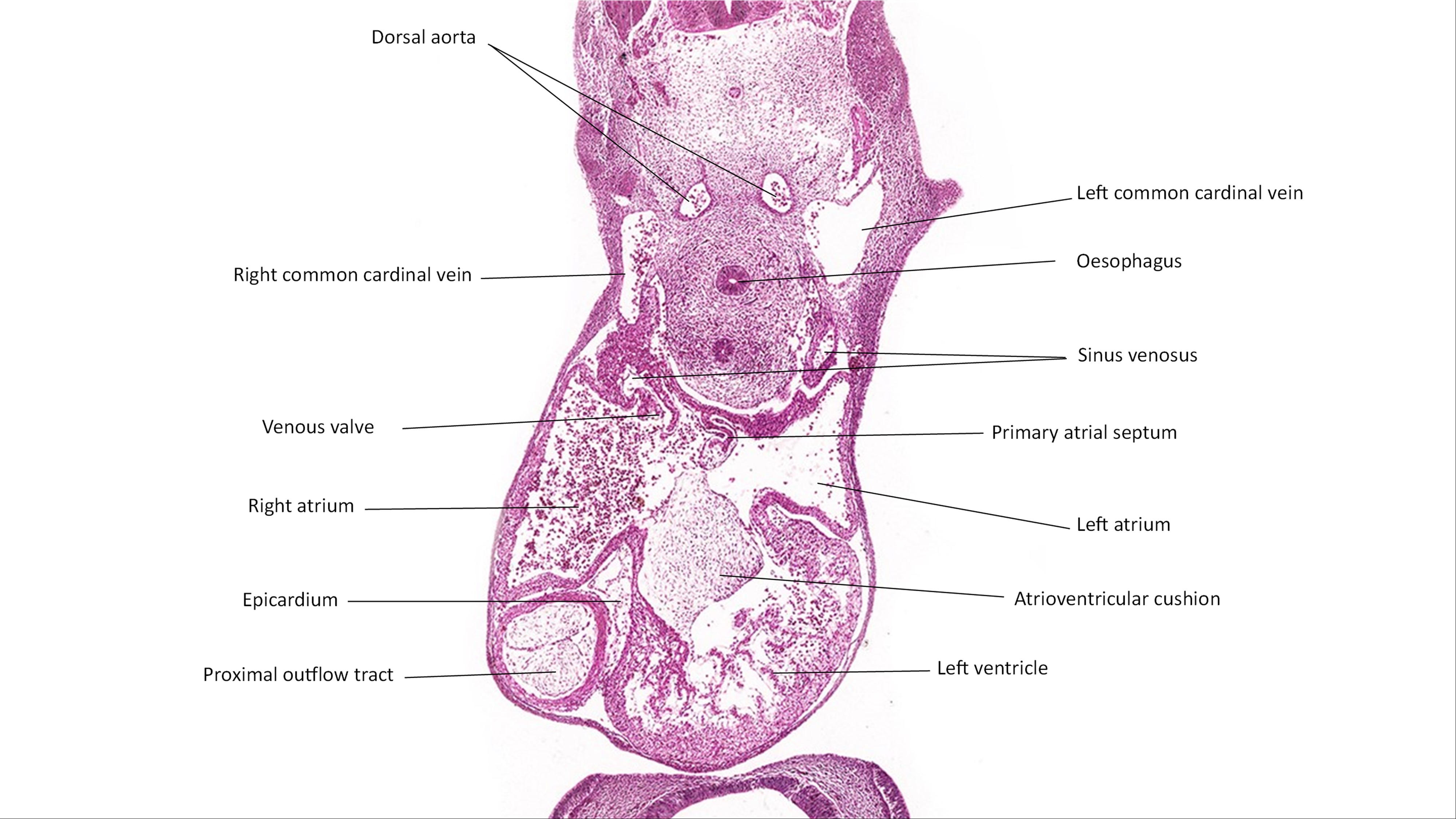 A histology section of a human embryo