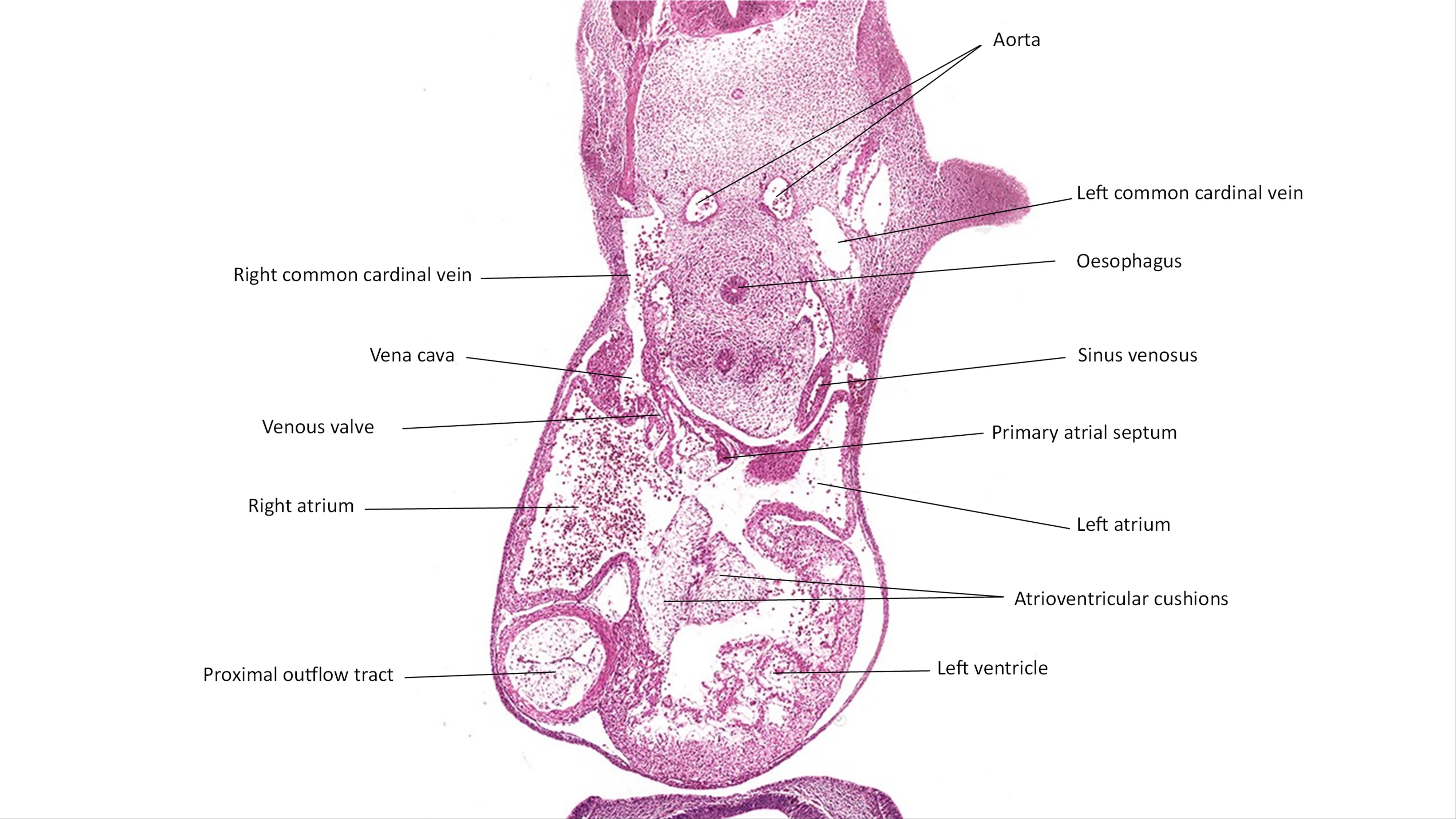 A histology section of a human embryo