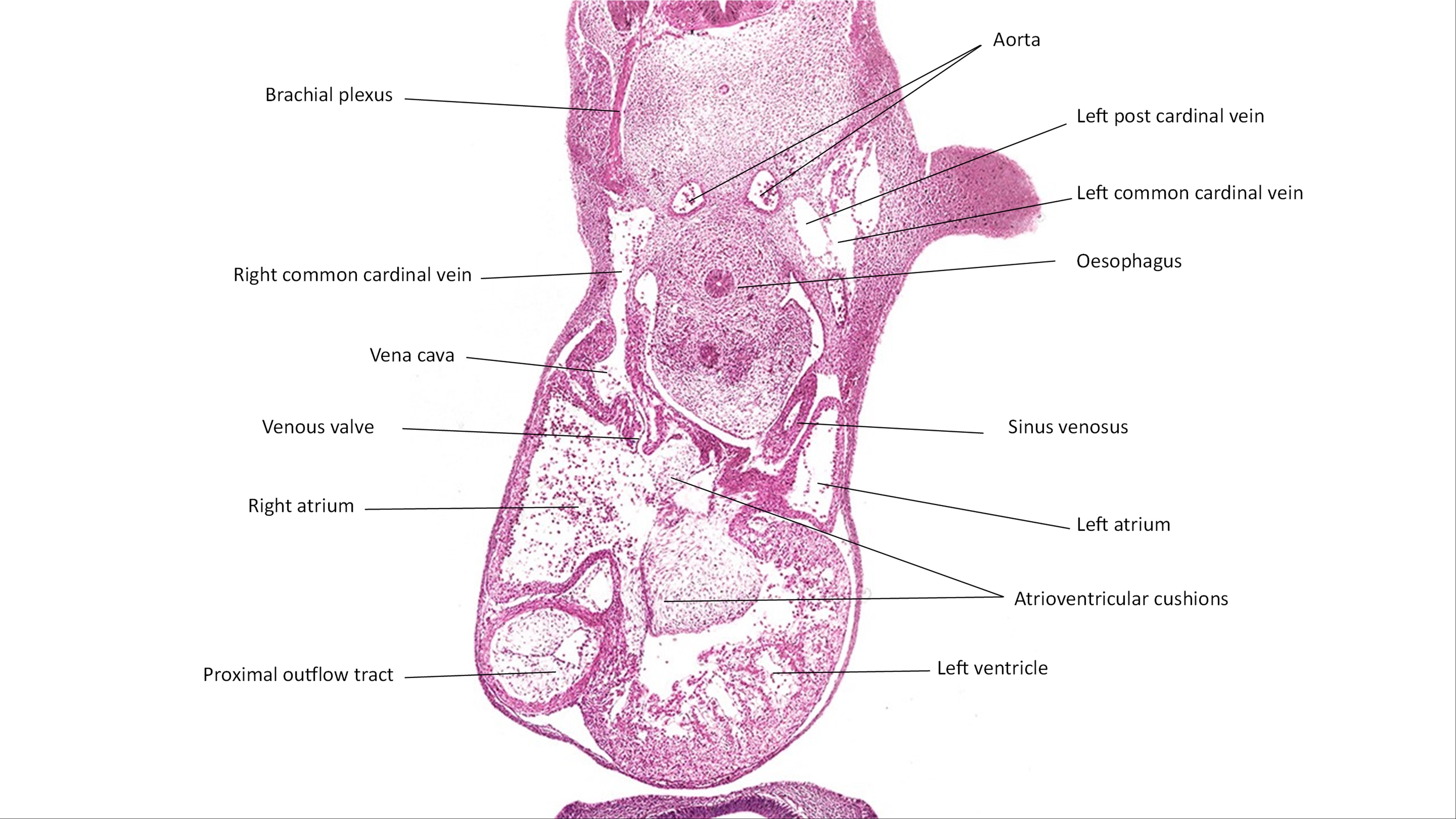 A histology section of a human embryo