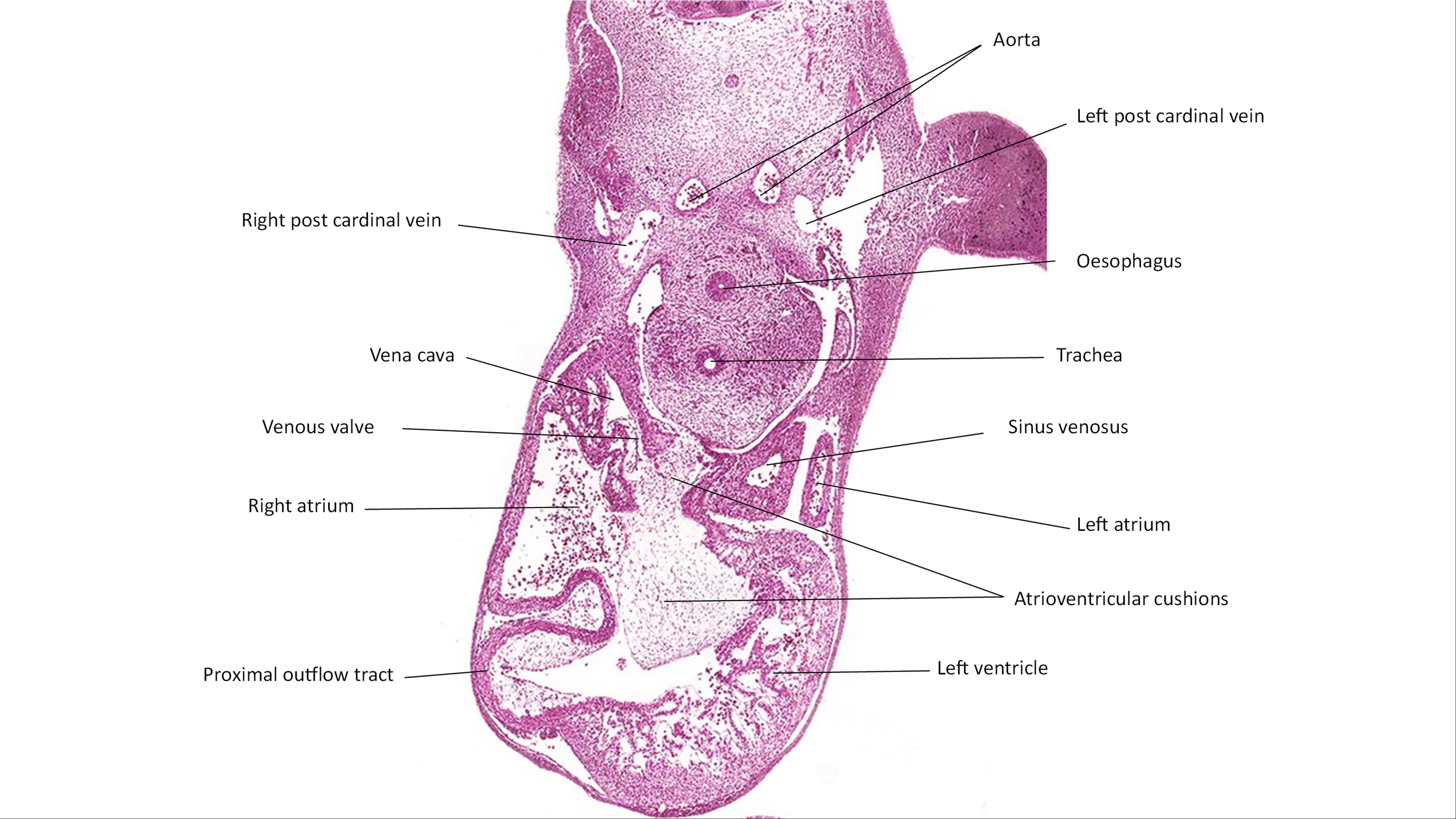 A histology section of a human embryo