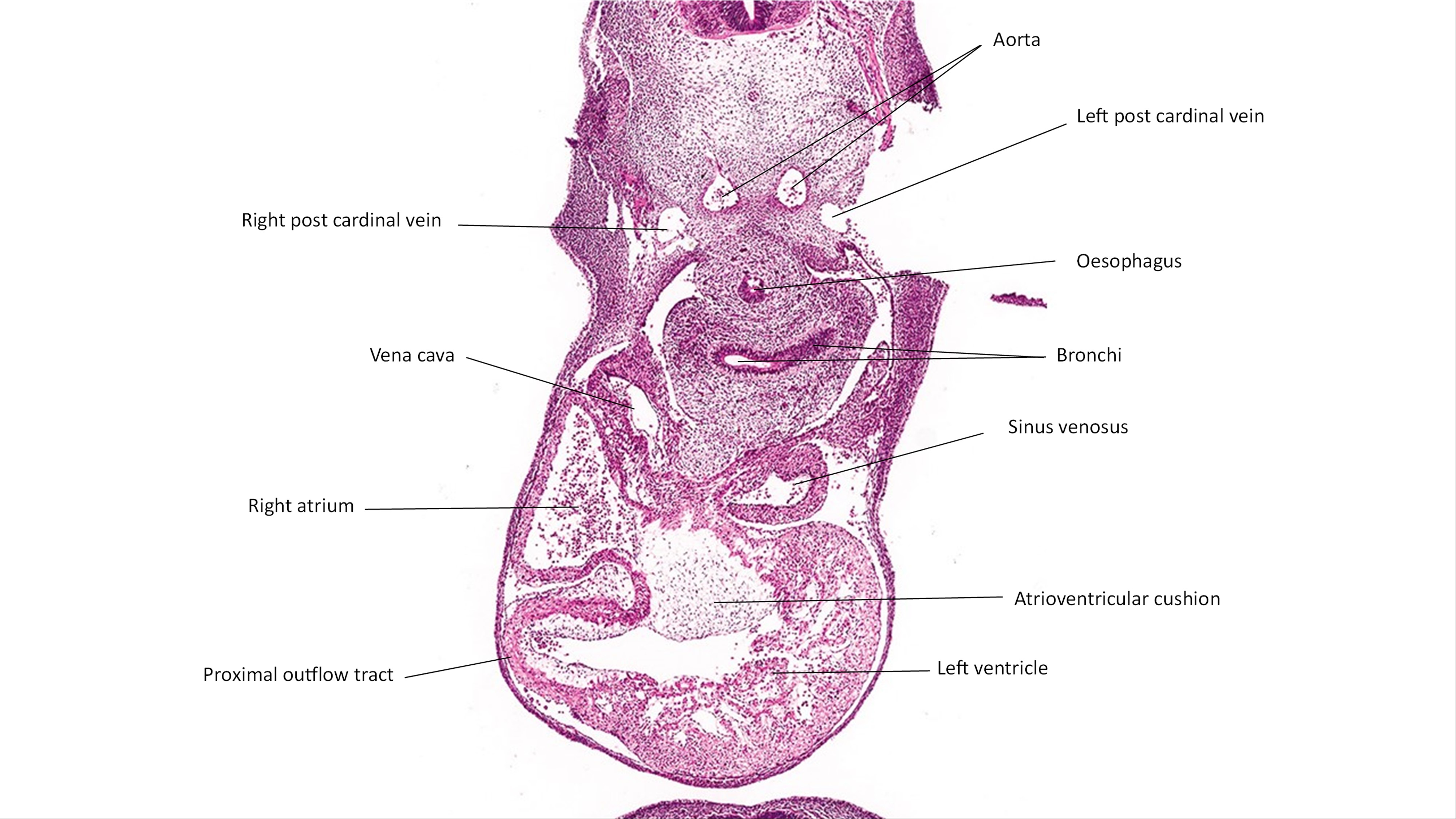 A histology section of a human embryo