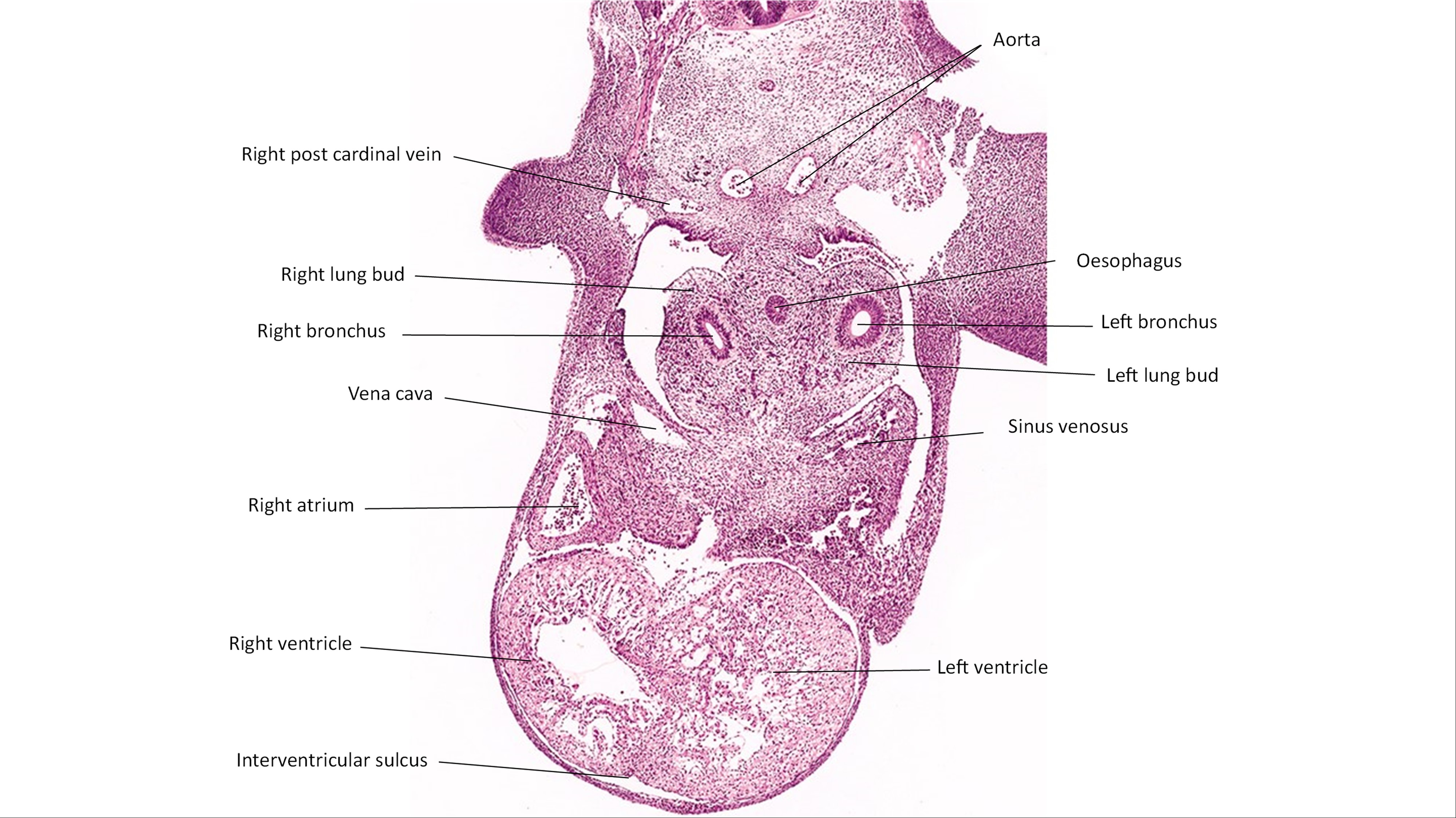 A histology section of a human embryo