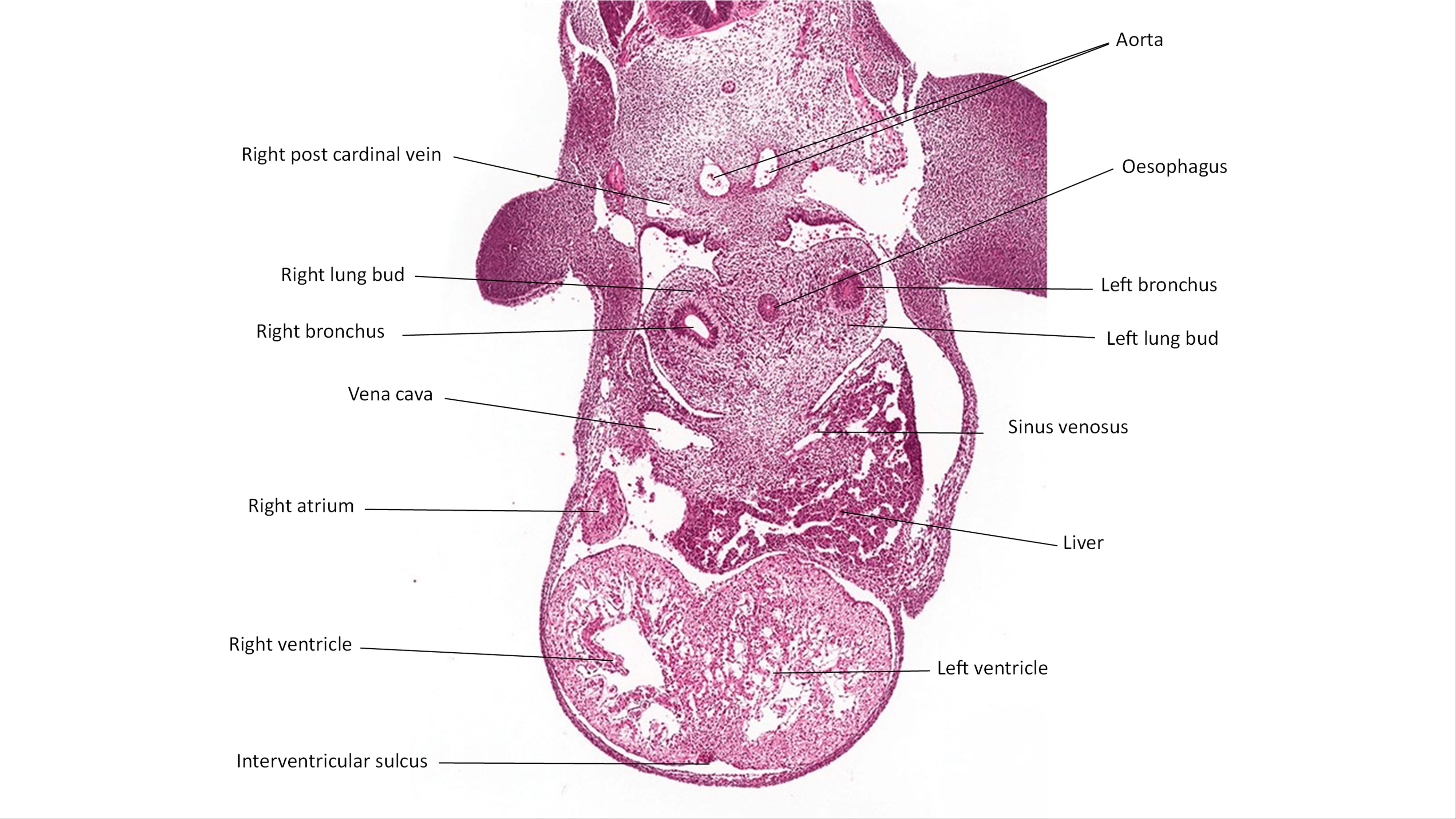 A histology section of a human embryo