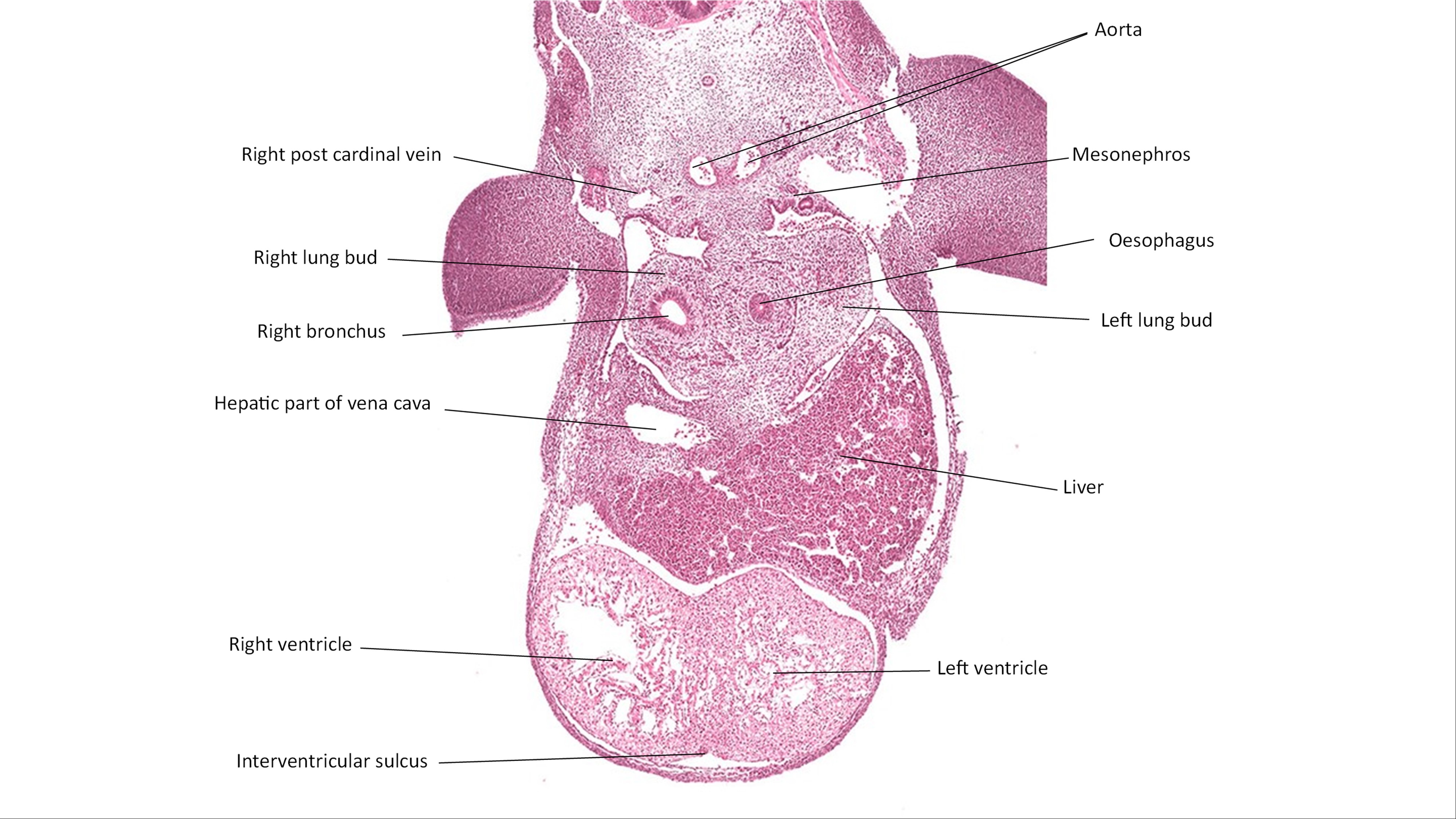 A histology section of a human embryo