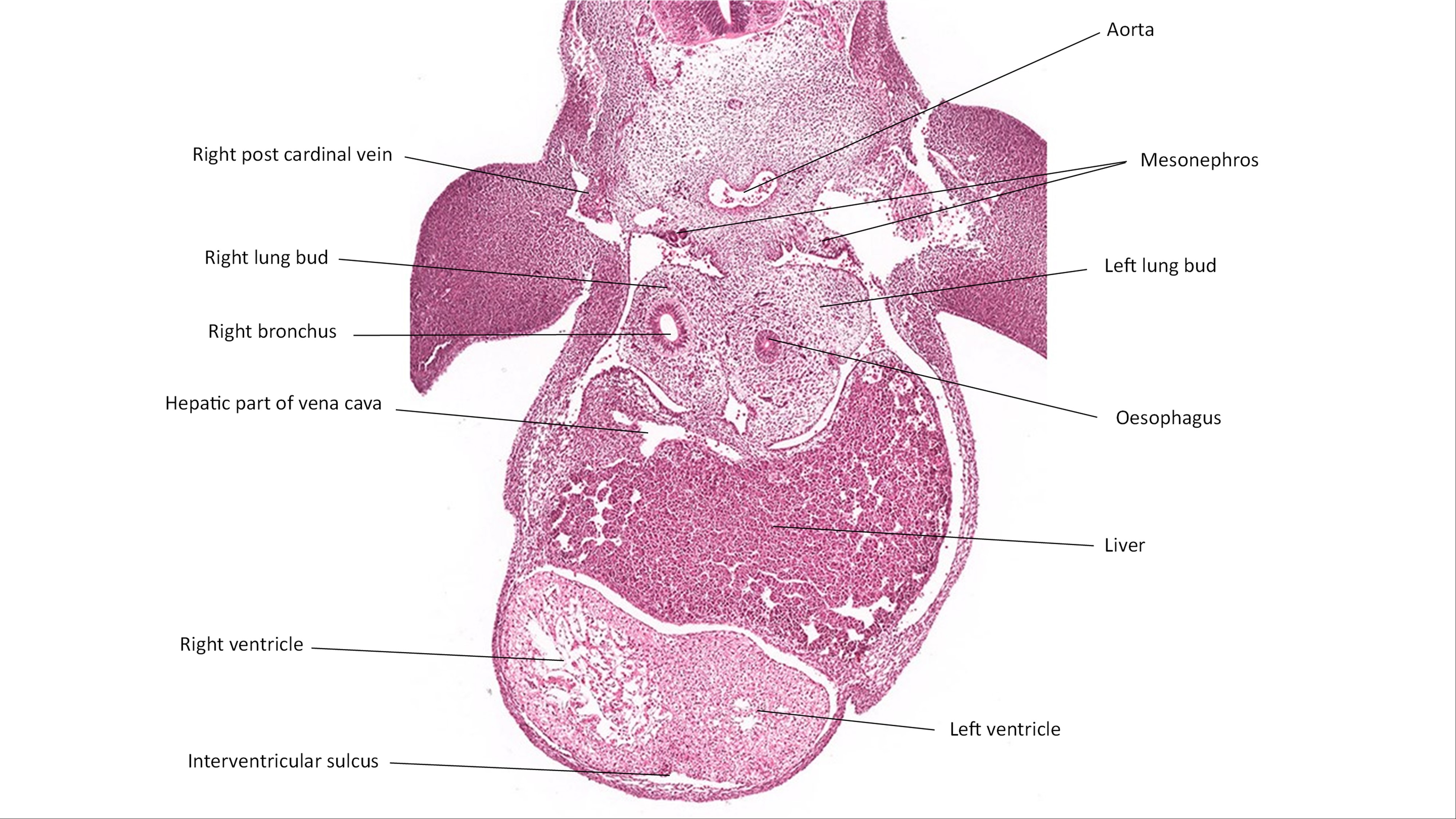 A histology section of a human embryo
