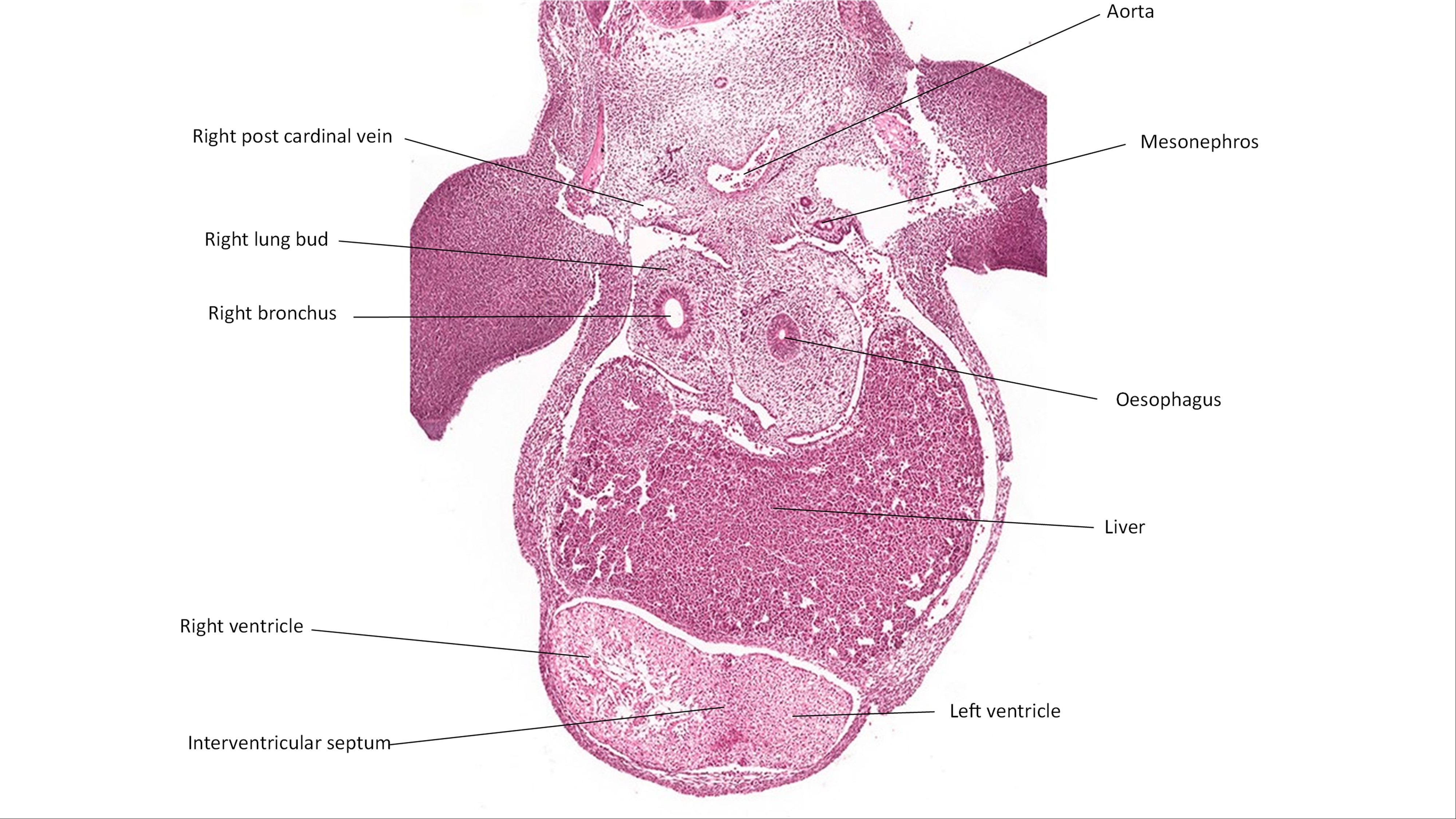 A histology section of a human embryo