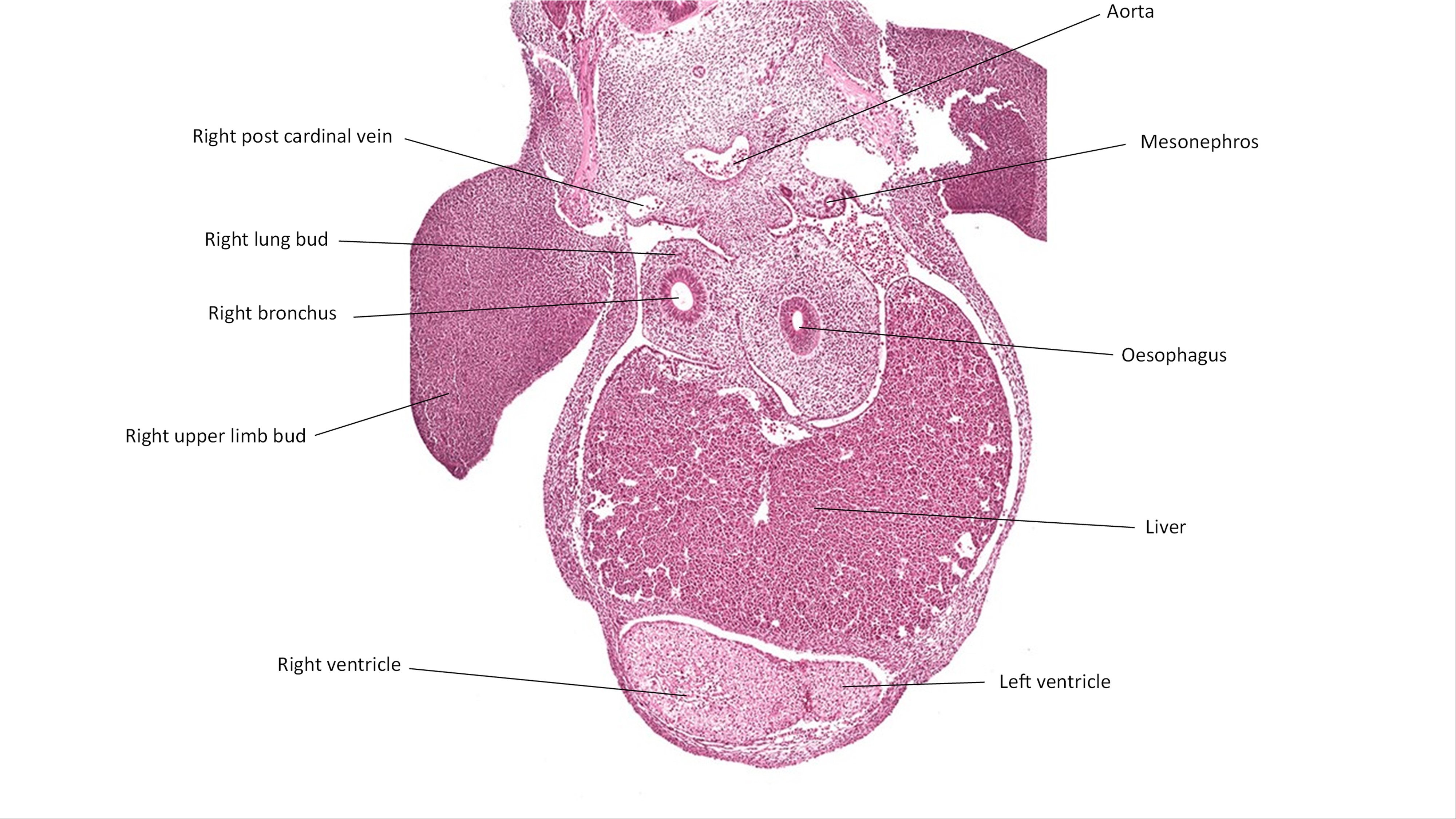 A histology section of a human embryo