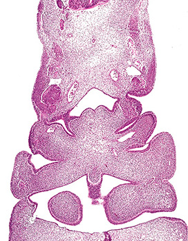 A histology section of a human embryo