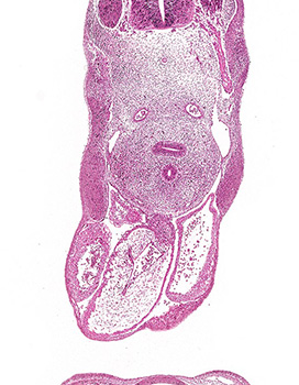 A histology section of a human embryo