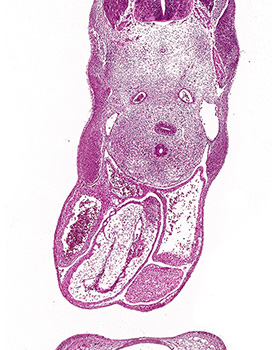 A histology section of a human embryo