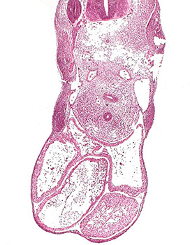 A histology section of a human embryo