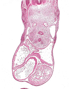 A histology section of a human embryo