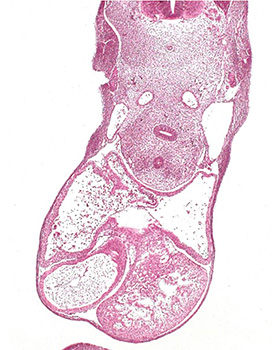 A histology section of a human embryo