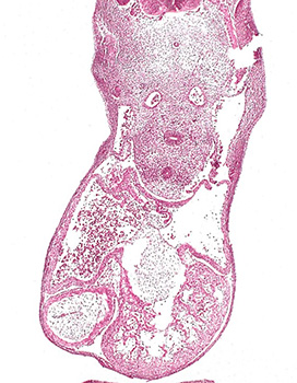A histology section of a human embryo