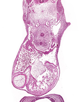 A histology section of a human embryo