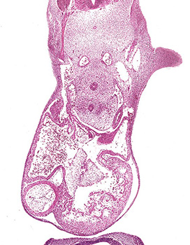 A histology section of a human embryo