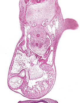 A histology section of a human embryo