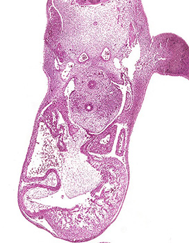 A histology section of a human embryo