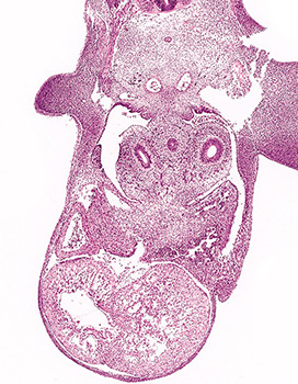 A histology section of a human embryo