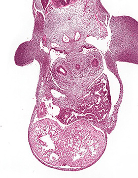 A histology section of a human embryo