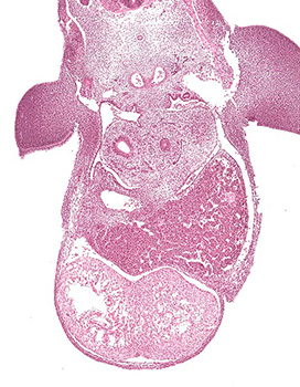 A histology section of a human embryo