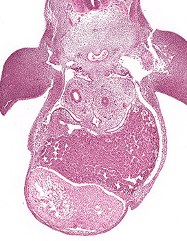 A histology section of a human embryo