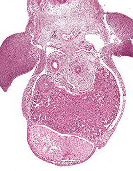 A histology section of a human embryo