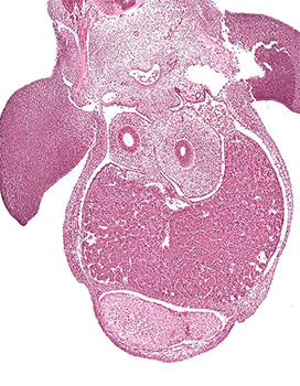 A histology section of a human embryo