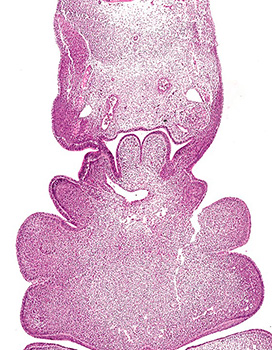 A histology section of a human embryo