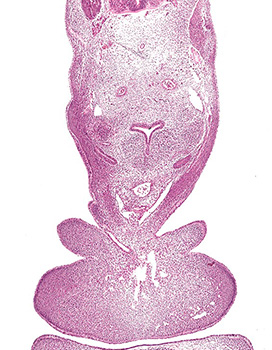 A histology section of a human embryo