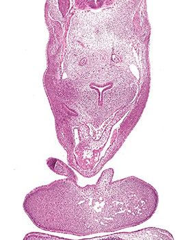 A histology section of a human embryo