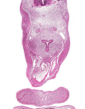A histology section of a human embryo
