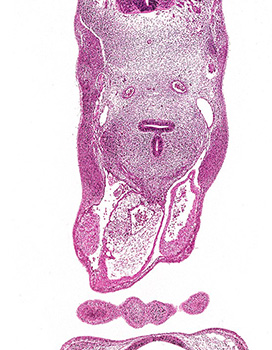 A histology section of a human embryo