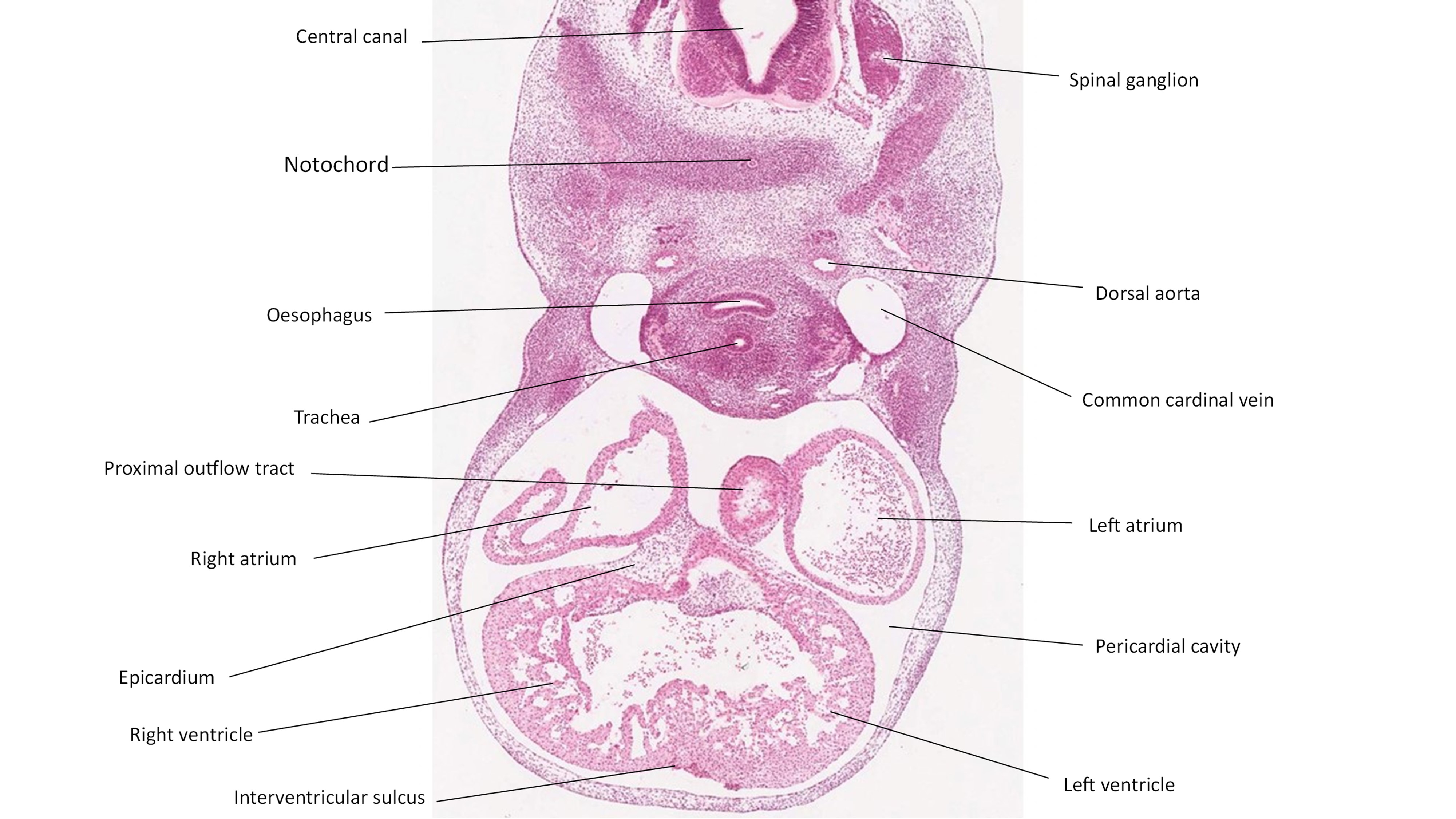 A histology section of a human embryo