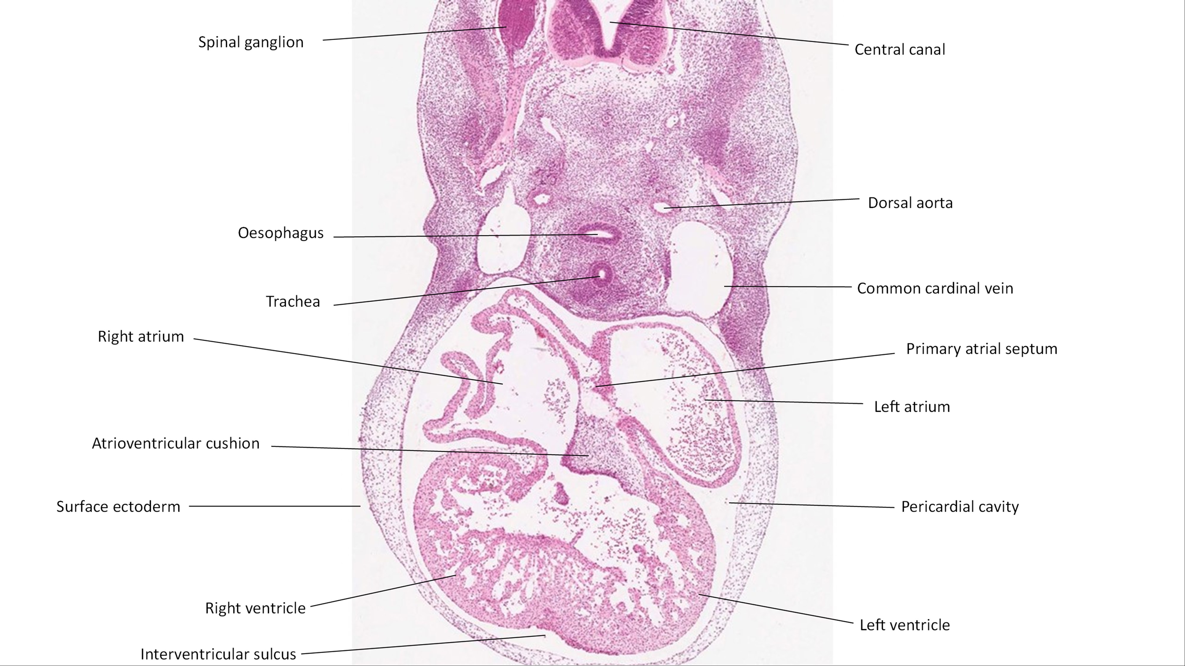 A histology section of a human embryo