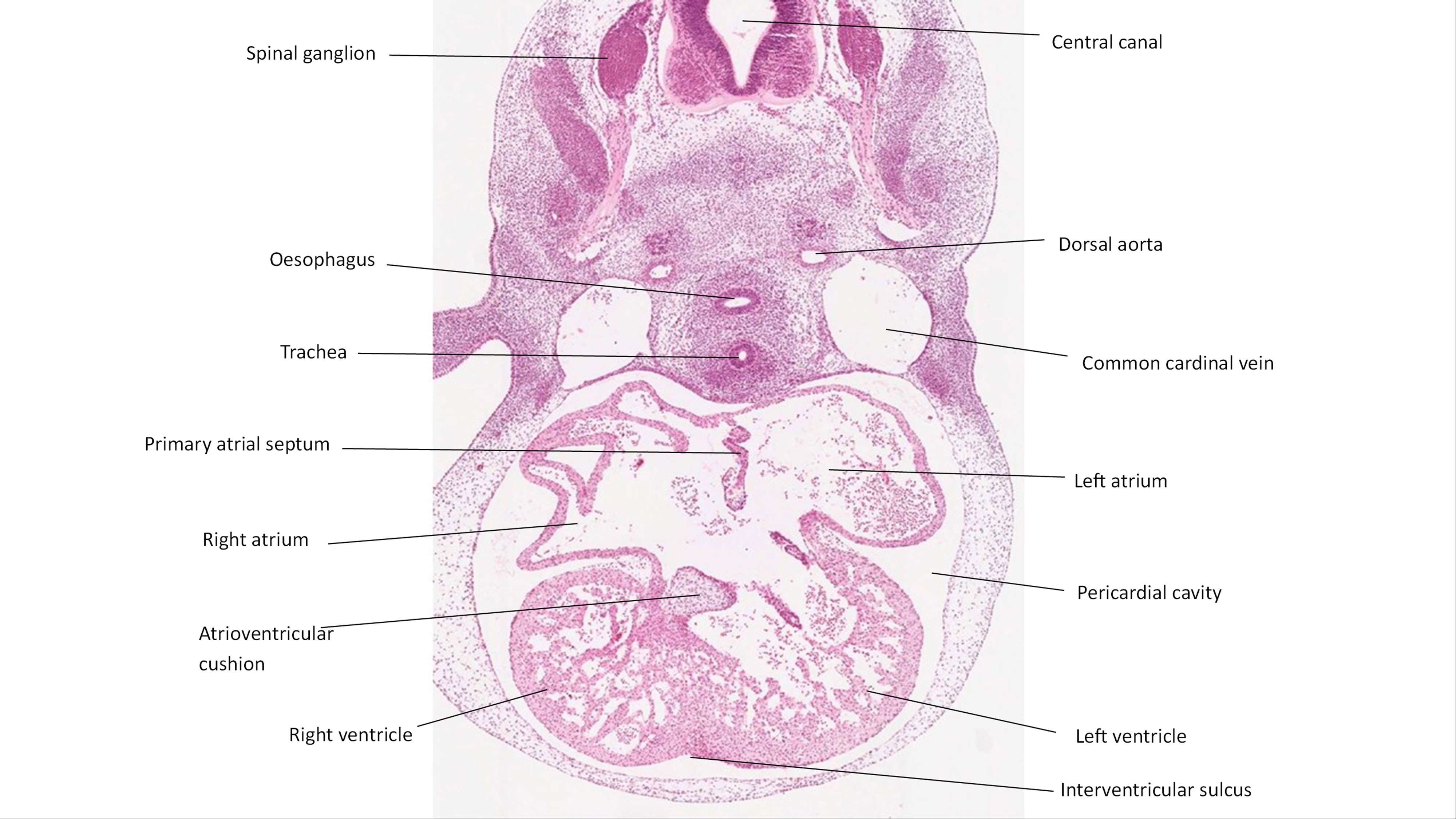 A histology section of a human embryo