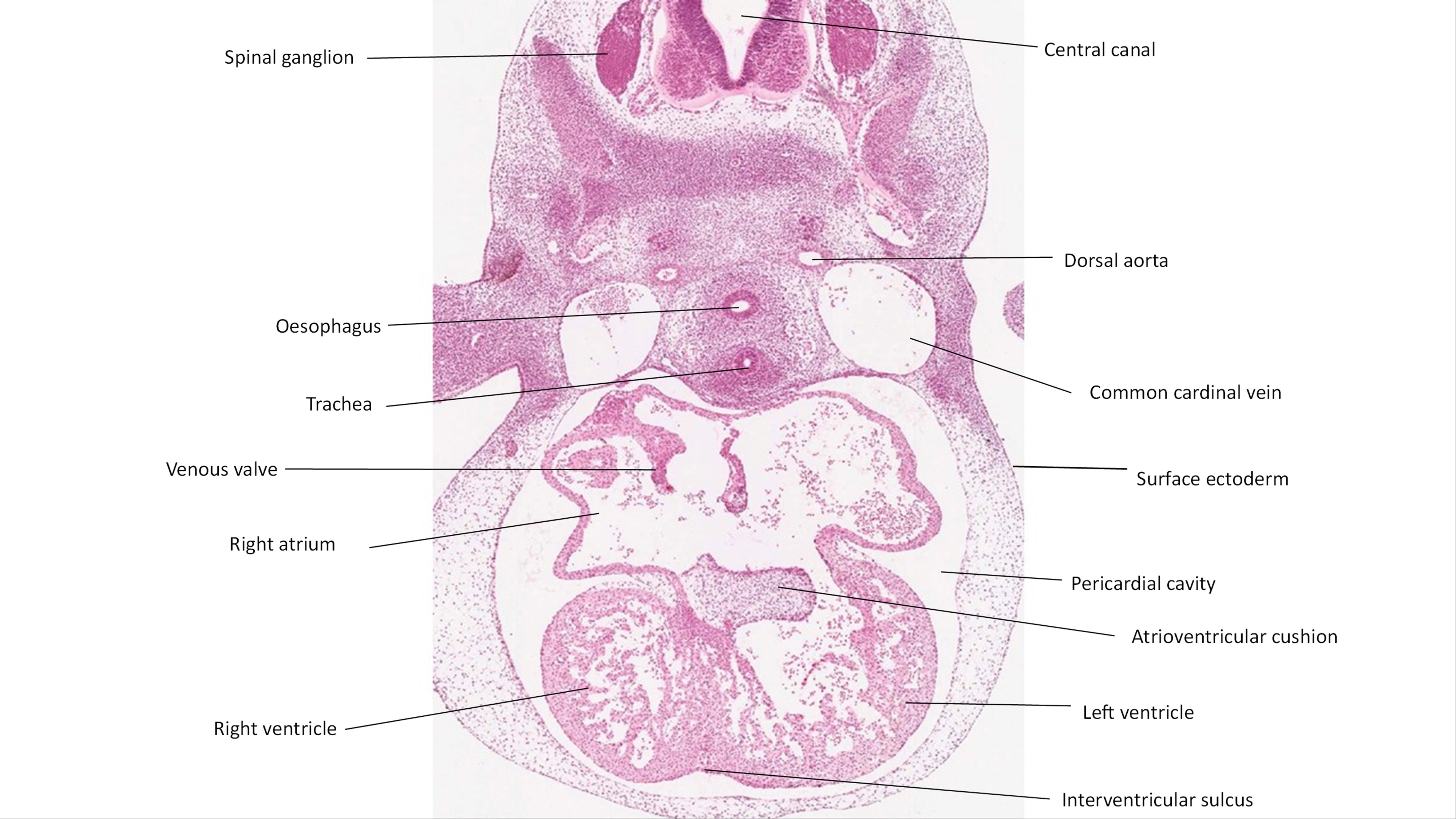 A histology section of a human embryo