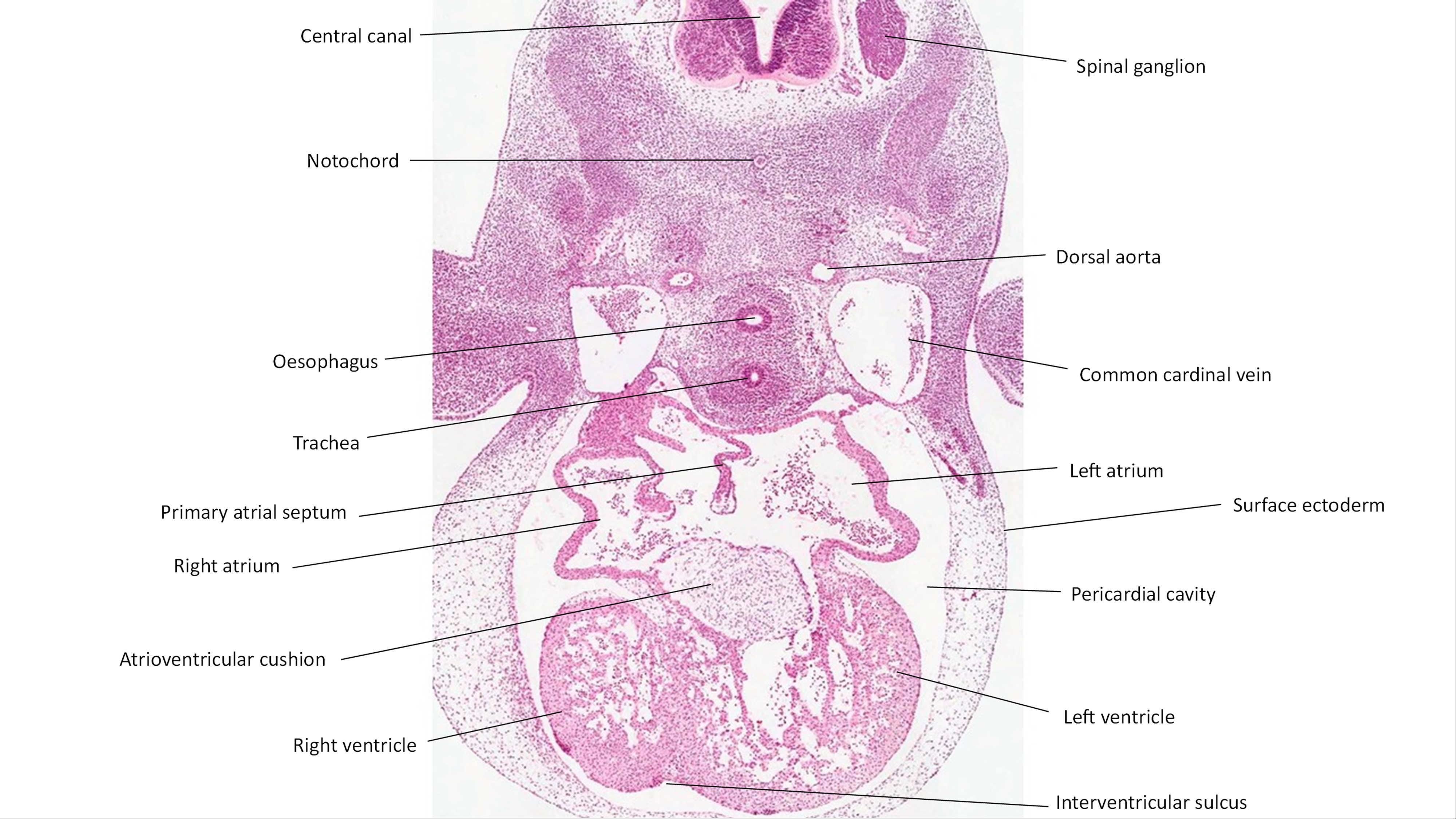 A histology section of a human embryo