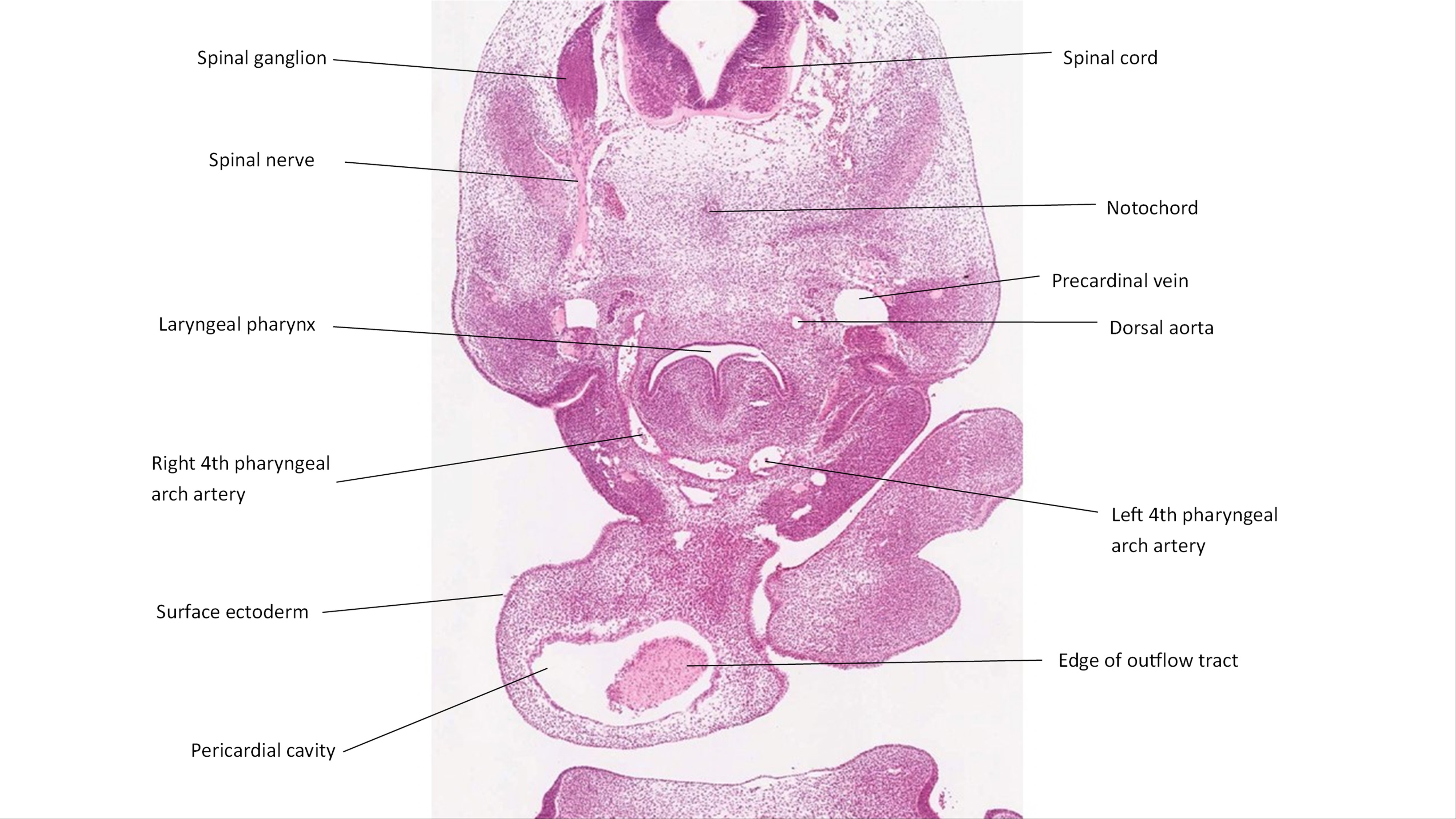 A histology section of a human embryo