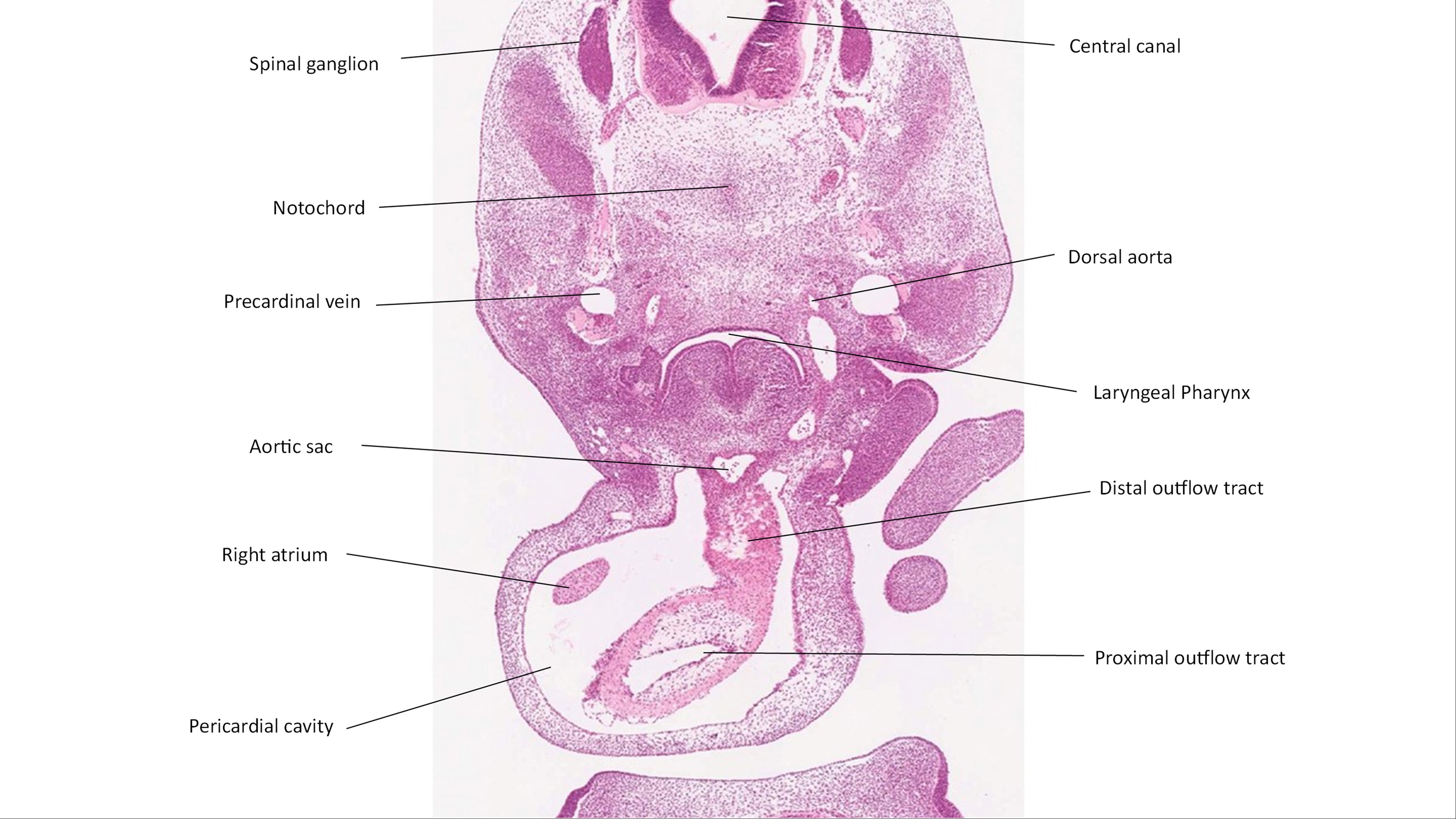 A histology section of a human embryo