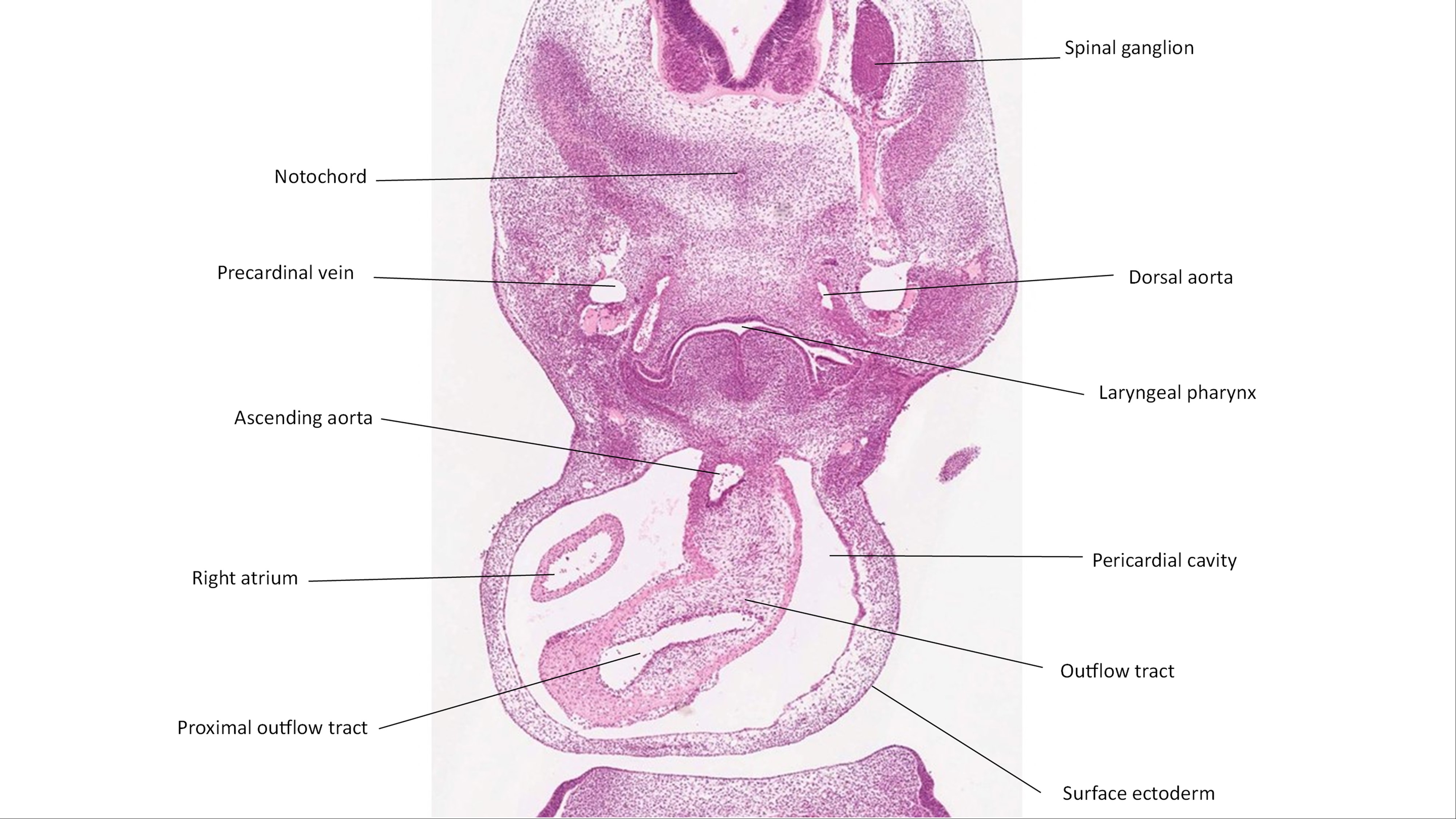 A histology section of a human embryo