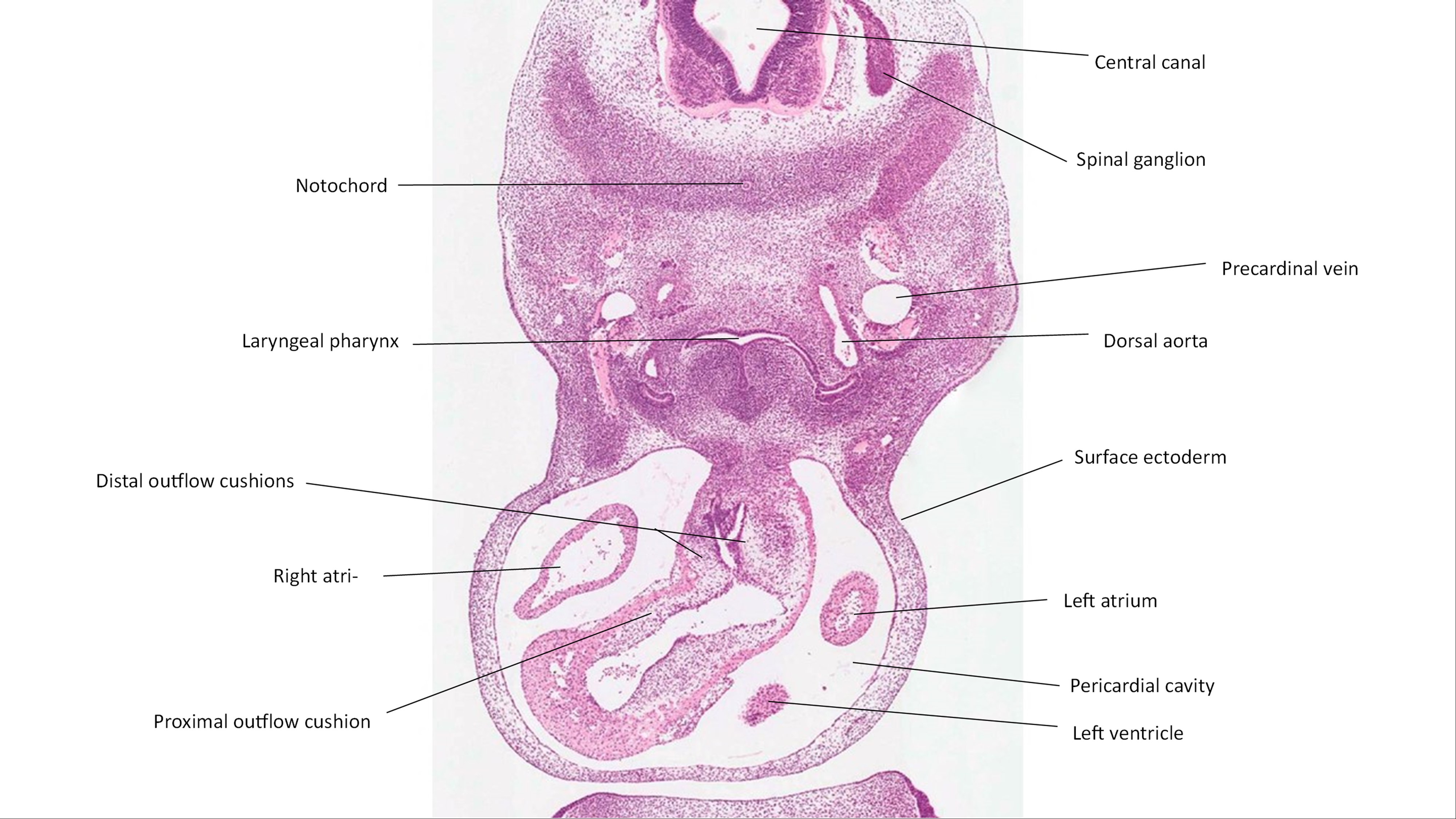 A histology section of a human embryo