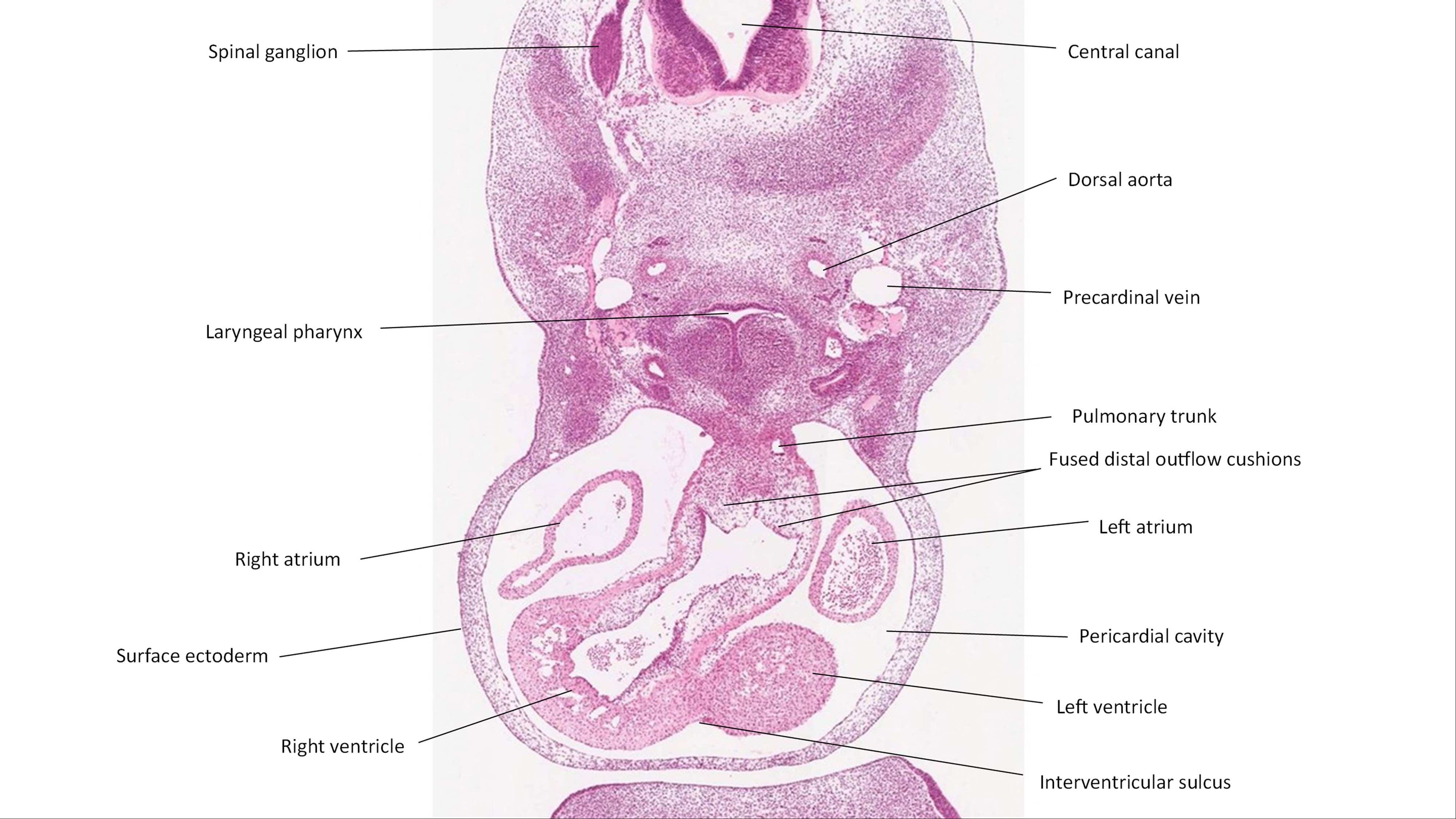 A histology section of a human embryo