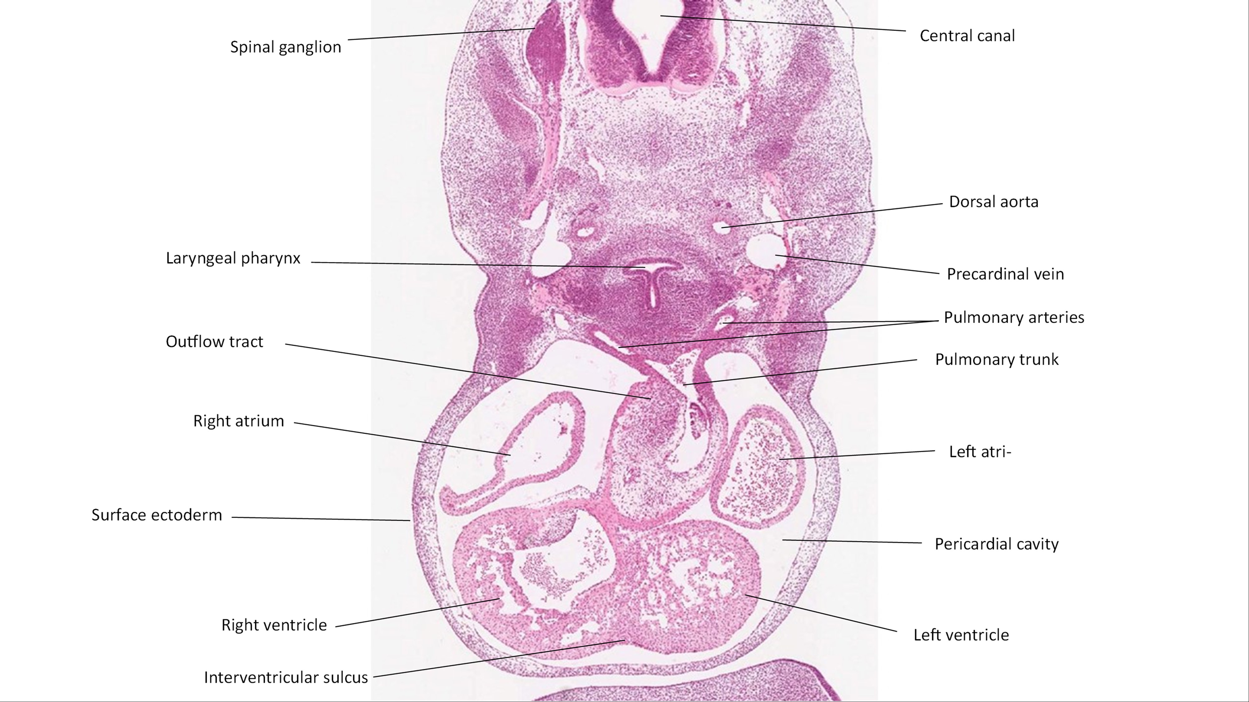 A histology section of a human embryo